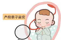 重庆市孕期亲子鉴定要怎么办理，重庆市孕期亲子鉴定结果准确吗